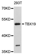 TBX19 / TPIT Antibody - Western blot analysis of extracts of 293T cells, using TBX19 antibody at 1:1000 dilution. The secondary antibody used was an HRP Goat Anti-Rabbit IgG (H+L) at 1:10000 dilution. Lysates were loaded 25ug per lane and 3% nonfat dry milk in TBST was used for blocking. An ECL Kit was used for detection and the exposure time was 30s.