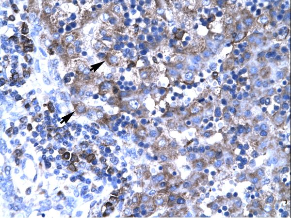 TBX19 / TPIT Antibody - TBX19 antibody ARP32363_T100-NP_005140-TBX19 (T-box 19) Antibody was used in IHC to stain formalin-fixed, paraffin-embedded human liver.  This image was taken for the unconjugated form of this product. Other forms have not been tested.