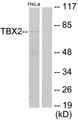 TBX2 Antibody - Western blot analysis of lysates from HeLa cells, using TBX2 Antibody. The lane on the right is blocked with the synthesized peptide.