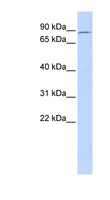 TBX2 Antibody - TBX2 antibody Western blot of Fetal Muscle lysate. This image was taken for the unconjugated form of this product. Other forms have not been tested.