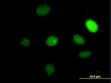 TBX2 Antibody - Immunofluorescence of monoclonal antibody to TBX2 on HeLa cell. [antibody concentration 30 ug/ml]