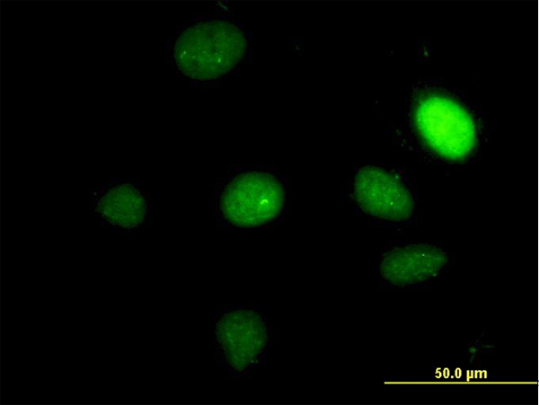 TBX2 Antibody - Immunofluorescence of monoclonal antibody to TBX2 on HeLa cell. [antibody concentration 30 ug/ml]