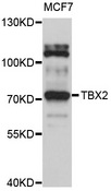 TBX2 Antibody - Western blot analysis of extracts of MCF-7 cells, using TBX2 antibody at 1:1000 dilution. The secondary antibody used was an HRP Goat Anti-Rabbit IgG (H+L) at 1:10000 dilution. Lysates were loaded 25ug per lane and 3% nonfat dry milk in TBST was used for blocking. An ECL Kit was used for detection and the exposure time was 5s.