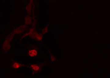 TBX2 Antibody - Staining HeLa cells by IF/ICC. The samples were fixed with PFA and permeabilized in 0.1% Triton X-100, then blocked in 10% serum for 45 min at 25°C. The primary antibody was diluted at 1:200 and incubated with the sample for 1 hour at 37°C. An Alexa Fluor 594 conjugated goat anti-rabbit IgG (H+L) Ab, diluted at 1/600, was used as the secondary antibody.