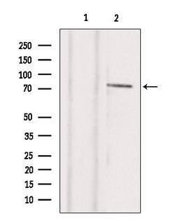 TBX2 Antibody - Western blot analysis of extracts of HepG2 cells using TBX2 antibody. Lane 1 was treated with the blocking peptide.
