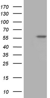 TBX20 Antibody - HEK293T cells were transfected with the pCMV6-ENTRY control. (Left lane) or pCMV6-ENTRY TBX20. (Right lane) cDNA for 48 hrs and lysed. Equivalent amounts of cell lysates. (5 ug per lane) were separated by SDS-PAGE and immunoblotted with anti-TBX20. (1:2000)