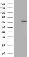 TBX20 Antibody - HEK293T cells were transfected with the pCMV6-ENTRY control. (Left lane) or pCMV6-ENTRY TBX20. (Right lane) cDNA for 48 hrs and lysed