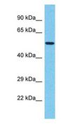 TBX20 Antibody - TBX20 antibody Western Blot of Jurkat. Antibody dilution: 1 ug/ml.  This image was taken for the unconjugated form of this product. Other forms have not been tested.