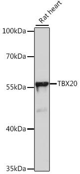 TBX20 Antibody - Western blot analysis of extracts of rat heart using TBX20 Polyclonal Antibody at dilution of 1:1000.