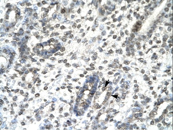 TBX21 / T-bet Antibody - TBX21 / T-bet antibody ARP32612_P050-NP_037483-TBX21 (T-box transcription factor ) Antibody was used in IHC to stain formalin-fixed, paraffin-embedded human kidney.  This image was taken for the unconjugated form of this product. Other forms have not been tested.