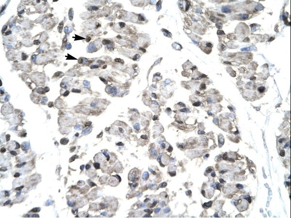 TBX21 / T-bet Antibody - Human Skeletal Muscle.  This image was taken for the unconjugated form of this product. Other forms have not been tested.