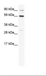 TBX21 / T-bet Antibody - SP2/0 Cell Lysate.  This image was taken for the unconjugated form of this product. Other forms have not been tested.