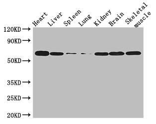 TBX21 / T-bet Antibody - Positive WB detected in:Mouse heart tissue,Mouse liver tissue,Mouse spleen tissue,Mouse lung tissue,Mouse kidney tissue,Mouse brain tissue,Mouse skeletal muscle tissue;All lanes: TBX21 antibody at 3ug/ml;Secondary;Goat polyclonal to rabbit IgG at 1/50000 dilution;Predicted band size: 59 kDa;Observed band size: 59 kDa;