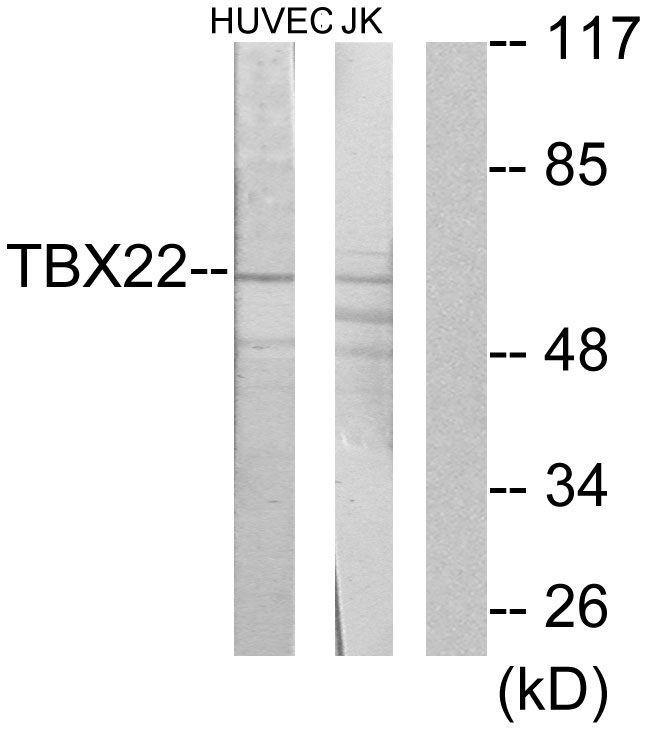 TBX22 Antibody - Western blot analysis of lysates from Jurkat and HUVEC cells, using TBX22 Antibody. The lane on the right is blocked with the synthesized peptide.
