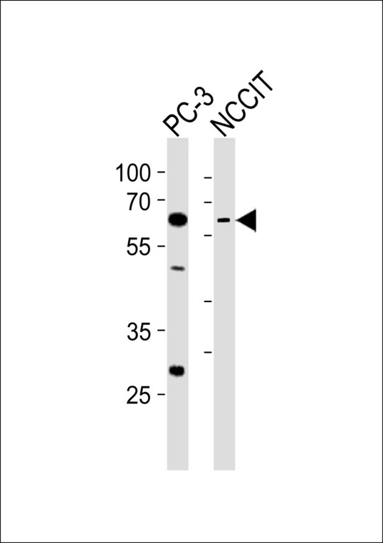 TBX22 Antibody - Western blot of lysates from PC-3, NCCIT cell line (from left to right) with TBX22 Antibody. Antibody was diluted at 1:1000 at each lane. A goat anti-rabbit IgG H&L (HRP) at 1:10000 dilution was used as the secondary antibody. Lysates at 35 ug per lane.