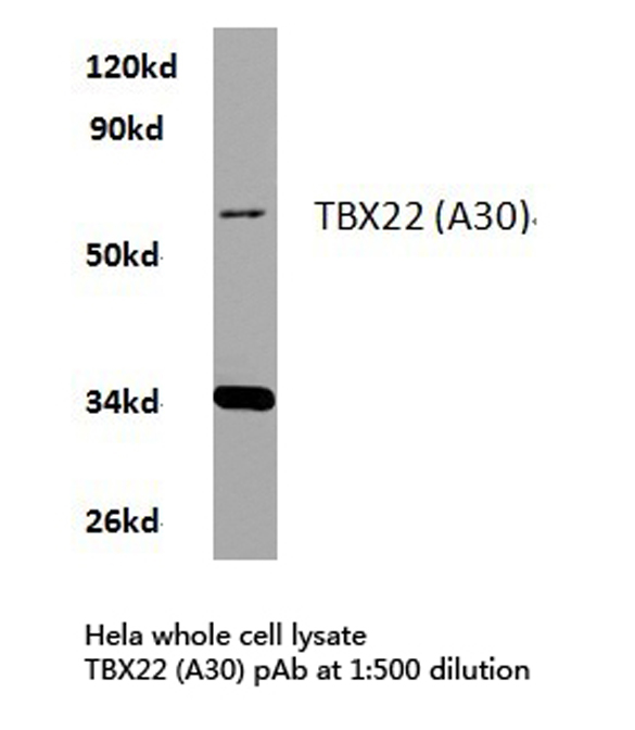 TBX22 Antibody - Western blot of TBX22 (A30) pAb in extracts from HeLa cells.