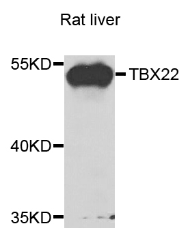 TBX22 Antibody - Western blot analysis of extracts of rat liver cells.