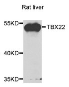 TBX22 Antibody - Western blot analysis of extracts of rat liver cells.