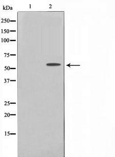 TBX22 Antibody - Western blot analysis on Jurkat cell lysates using TBX22 antibody. The lane on the left is treated with the antigen-specific peptide.