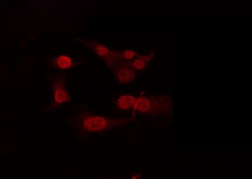 TBX22 Antibody - Staining HeLa cells by IF/ICC. The samples were fixed with PFA and permeabilized in 0.1% Triton X-100, then blocked in 10% serum for 45 min at 25°C. The primary antibody was diluted at 1:200 and incubated with the sample for 1 hour at 37°C. An Alexa Fluor 594 conjugated goat anti-rabbit IgG (H+L) Ab, diluted at 1/600, was used as the secondary antibody.