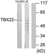 TBX22 Antibody - Western blot analysis of extracts from HUVEC cells and Jurkat cells, using TBX22 antibody.