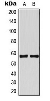 TBX22 Antibody - Western blot analysis of TBX22 expression in HeLa (A); Jurkat (B) whole cell lysates.