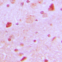 TBX22 Antibody - Immunohistochemical analysis of TBX22 staining in human brain formalin fixed paraffin embedded tissue section. The section was pre-treated using heat mediated antigen retrieval with sodium citrate buffer (pH 6.0). The section was then incubated with the antibody at room temperature and detected using an HRP conjugated compact polymer system. DAB was used as the chromogen. The section was then counterstained with hematoxylin and mounted with DPX.