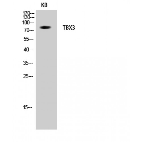TBX3 Antibody - Western blot of TBX3 antibody
