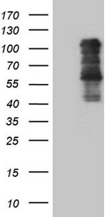 TBX3 Antibody - HEK293T cells were transfected with the pCMV6-ENTRY control. (Left lane) or pCMV6-ENTRY TBX3. (Right lane) cDNA for 48 hrs and lysed