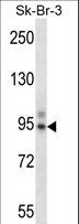 TBX3 Antibody - TBX3 Antibody western blot of SK-BR-3 cell line lysates (35 ug/lane). The TBX3 antibody detected the TBX3 protein (arrow).