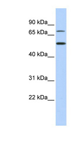 TBX3 Antibody - TBX3 antibody Western blot of 721_B cell lysate. This image was taken for the unconjugated form of this product. Other forms have not been tested.