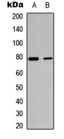 TBX3 Antibody - Western blot analysis of TBX3 expression in HepG2 (A); MCF7 (B) whole cell lysates.