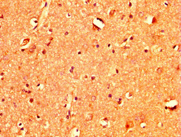 TBX3 Antibody - Immunohistochemistry image at a dilution of 1:400 and staining in paraffin-embedded human brain tissue performed on a Leica BondTM system. After dewaxing and hydration, antigen retrieval was mediated by high pressure in a citrate buffer (pH 6.0) . Section was blocked with 10% normal goat serum 30min at RT. Then primary antibody (1% BSA) was incubated at 4 °C overnight. The primary is detected by a biotinylated secondary antibody and visualized using an HRP conjugated SP system.