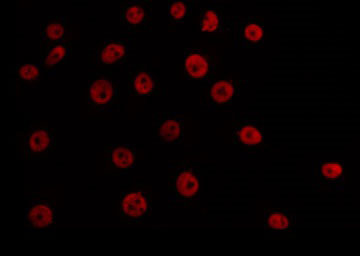 TBX3 Antibody - Staining A549 cells by IF/ICC. The samples were fixed with PFA and permeabilized in 0.1% Triton X-100, then blocked in 10% serum for 45 min at 25°C. The primary antibody was diluted at 1:200 and incubated with the sample for 1 hour at 37°C. An Alexa Fluor 594 conjugated goat anti-rabbit IgG (H+L) Ab, diluted at 1/600, was used as the secondary antibody.