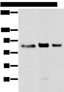 TBX3 Antibody - Western blot analysis of 293T cell  using TBX3 Polyclonal Antibody at dilution of 1:200