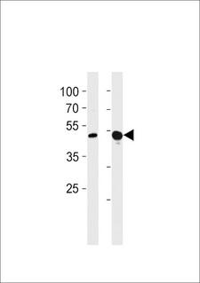 TBX4 Antibody - TBX4 Antibody western blot of A549,mouse NIH/3T3 cell line lysates (35 ug/lane). The TBX4 antibody detected the TBX4 protein (arrow).