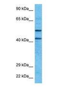 TBX4 Antibody - Western blot of TBX4 Antibody with human HT1080 Whole Cell lysate.  This image was taken for the unconjugated form of this product. Other forms have not been tested.