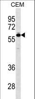 TBX5 Antibody - TBX5 Antibody western blot of CEM cell line lysates (35 ug/lane). The TBX5 antibody detected the TBX5 protein (arrow).