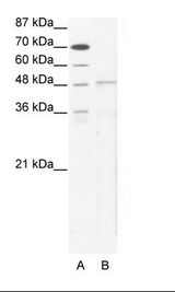 TBX5 Antibody - A: Marker, B: HepG2 Cell Lysate.  This image was taken for the unconjugated form of this product. Other forms have not been tested.