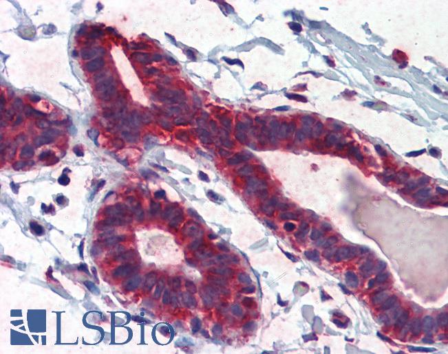 TBX5 Antibody - Anti-TBX5 antibody IHC of human breast. Immunohistochemistry of formalin-fixed, paraffin-embedded tissue after heat-induced antigen retrieval. Antibody concentration 5 ug/ml.  This image was taken for the unconjugated form of this product. Other forms have not been tested.