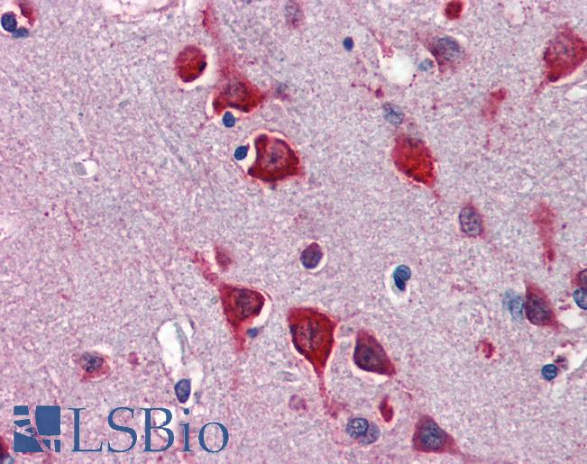 TBX5 Antibody - Anti-TBX5 antibody IHC of human brain, cortex. Immunohistochemistry of formalin-fixed, paraffin-embedded tissue after heat-induced antigen retrieval. Antibody concentration 5 ug/ml.  This image was taken for the unconjugated form of this product. Other forms have not been tested.