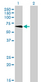 TBX5 Antibody - Western Blot analysis of TBX5 expression in transfected 293T cell line by TBX5 monoclonal antibody (M01), clone 1G10.Lane 1: TBX5 transfected lysate(57.7 KDa).Lane 2: Non-transfected lysate.