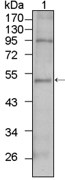 TBX5 Antibody - Western blot using TBX5 mouse monoclonal antibody against HepG2 cell lysate (1).
