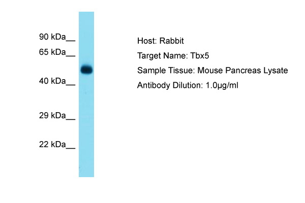 TBX5 Antibody -  This image was taken for the unconjugated form of this product. Other forms have not been tested.