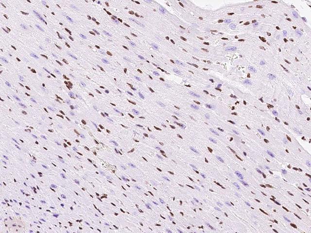 TBX5 Antibody - Immunochemical staining TBX5 in mouse heart with rabbit polyclonal antibody at 1:1000 dilution, formalin-fixed paraffin embedded sections.
