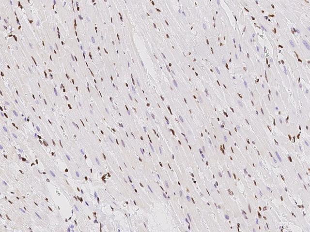 TBX5 Antibody - Immunochemical staining TBX5 in rat heart with rabbit polyclonal antibody at 1:1000 dilution, formalin-fixed paraffin embedded sections.