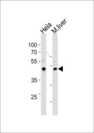TBX6 Antibody - TBX6 Antibody (Center W158) western blot of HeLa cell line and mouse liver tissue lysates (35 ug/lane). The TBX6 antibody detected the TBX6 protein (arrow).