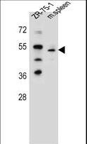 TBX6 Antibody - TBX6 Antibody western blot of ZR-75-1 cell line and mouse spleen tissue lysates (35 ug/lane). The TBX6 antibody detected the TBX6 protein (arrow).