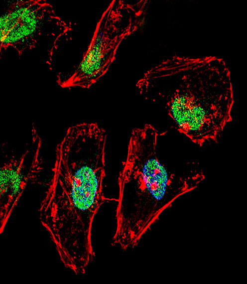 TBX6 Antibody - Fluorescent confocal image of HeLa cell stained with TBX6 Antibody. HeLa cells were fixed with 4% PFA (20 min), permeabilized with Triton X-100 (0.1%, 10 min), then incubated with TBX6 primary antibody (1:25, 1 h at 37°C). For secondary antibody, Alexa Fluor 488 conjugated donkey anti-rabbit antibody (green) was used (1:400, 50 min at 37°C). Cytoplasmic actin was counterstained with Alexa Fluor 555 (red) conjugated Phalloidin (7units/ml, 1 h at 37°C). Nuclei were counterstained with DAPI (blue) (10 ug/ml, 10 min). TBX6 immunoreactivity is localized to nucleus significantly.