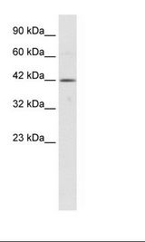 TBX6 Antibody - Jurkat Cell Lysate.  This image was taken for the unconjugated form of this product. Other forms have not been tested.